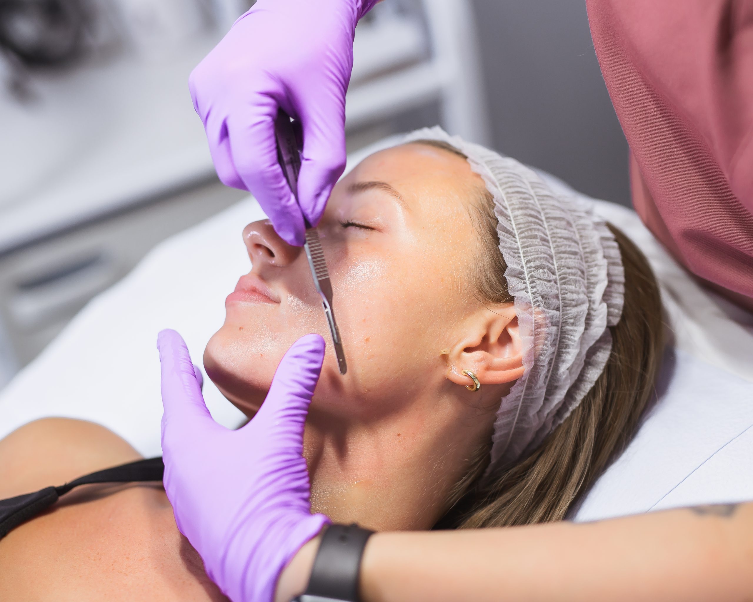 Patient receiving dermaplaning treatment